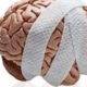Concussion
