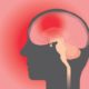 Understanding acute concussion